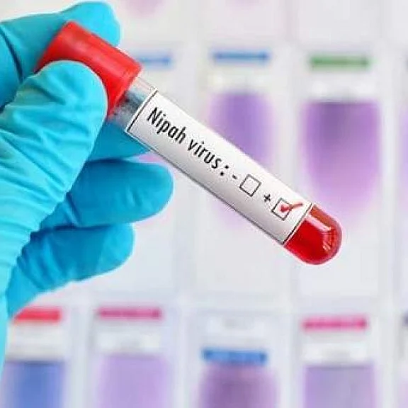 நிபா வைரஸ்