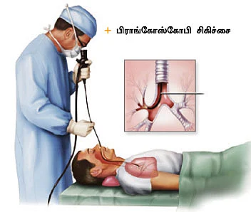 உங்களை யாரும் நினைக்க வேண்டாம்!