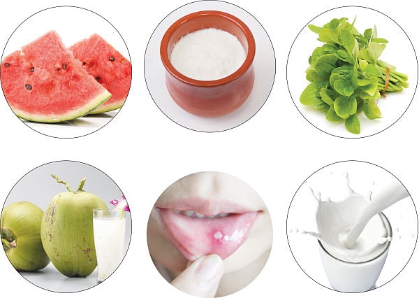 டாக்டர் டவுட் - வாய்ப்புண்