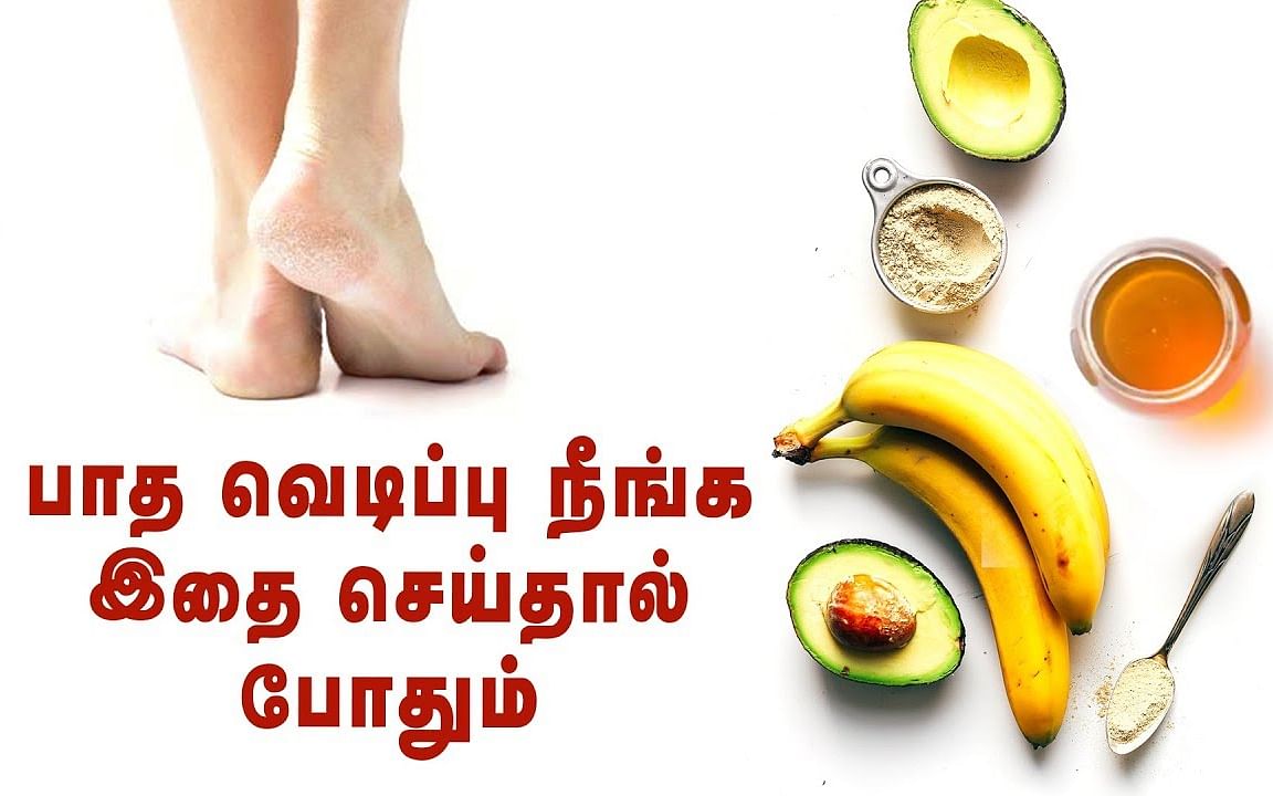 How to: பாதவெடிப்பை சரிசெய்வது எப்படி? I How to get rid of cracked heels? 