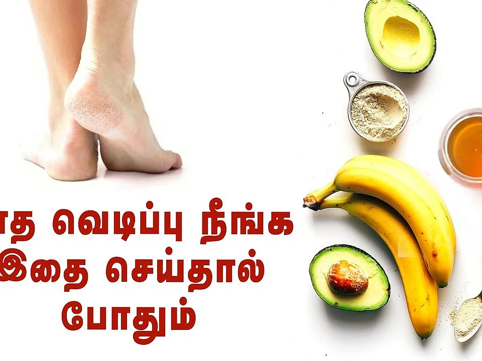 How to: பாதவெடிப்பை சரிசெய்வது எப்படி? I How to get rid of cracked heels?