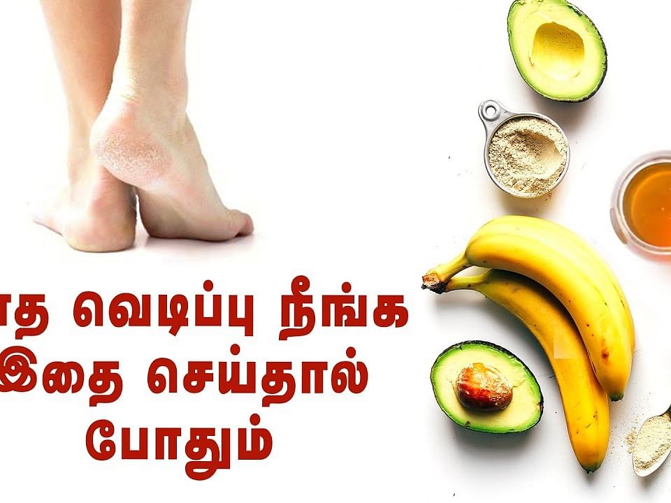How to: பாதவெடிப்பை சரிசெய்வது எப்படி? I How to get rid of cracked heels? 