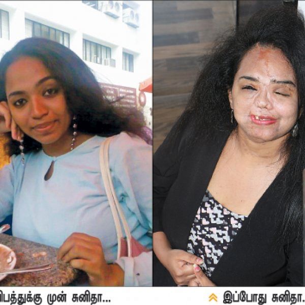 கீழே விழுவோம்... எழுந்திருக்கத் தெரிஞ்சிருக்கணும்... அதுதான் வாழ்க்கை! - சுனிதா அடினஸ்