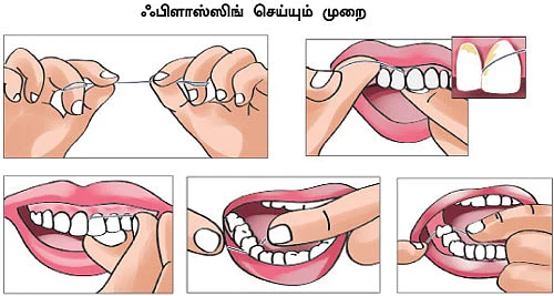 வாயைத் திற... வாசம் வரும்!