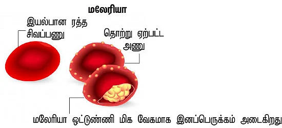 மலேரியாவுக்கு முடிவுகட்டுவோம்!
