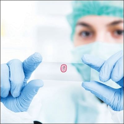 வலி இல்லாத பயாப்சி பரிசோதனை! - மாடர்ன் மெடிசின்.காம் - 1