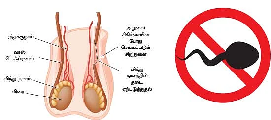 மனைவியை நேசிக்கிறவங்க...