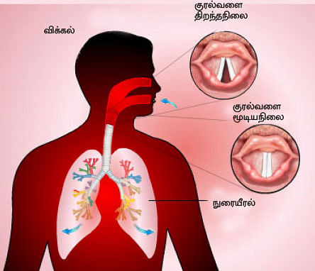 விடாது விக்கல்!