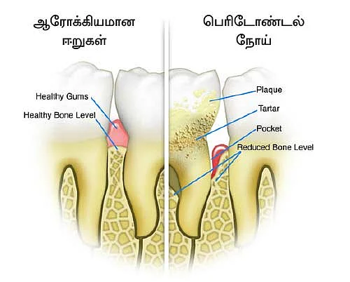 குட்பை டயாபடீஸ்!