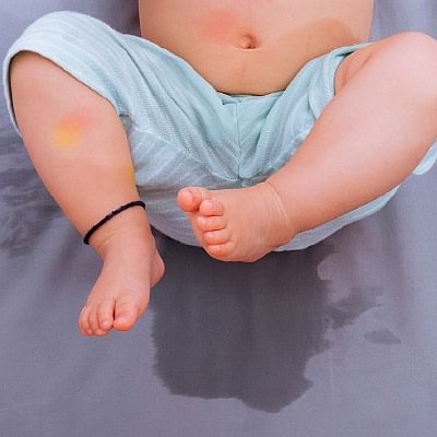 பெட் வெட்டிங் - தவிர்க்க 10 வழிகள்