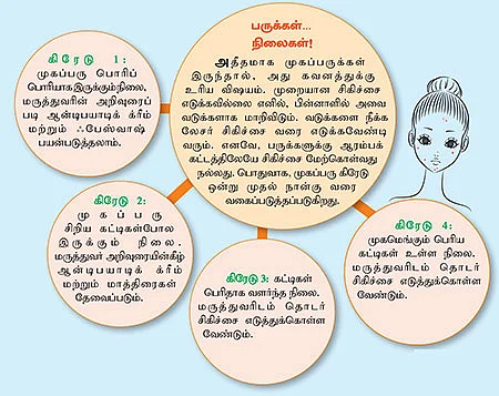 பிம்பிள் பிரச்சனை... சிம்பிள் தீர்வுகள்!