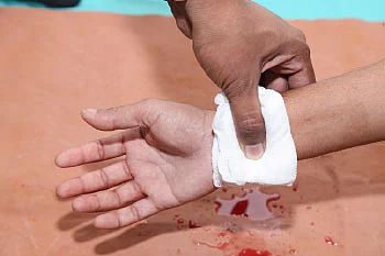 முதலுதவி யாருக்கு? எப்போது? எப்படி?