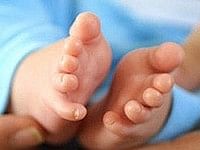 Doctor Vikatan: பிறக்கும்போதே குழந்தைகளுக்கு மஞ்சள் காமாலை வருமா?