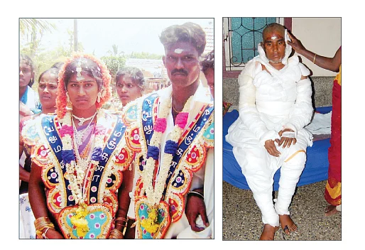 உலகம் முழுவதும் பரவும் டெங்கு கொசுவரூபம் உங்களையும் தாக்கலாம் உஷார்!