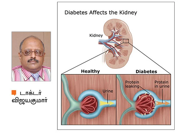 குட்பை டயாபடீஸ்!