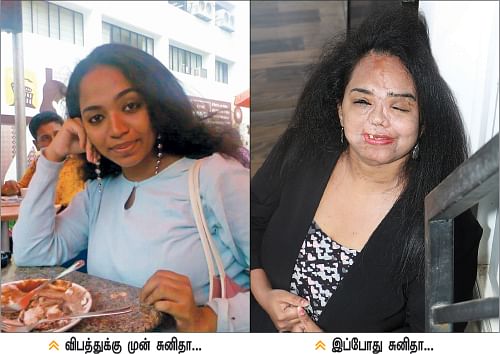 கீழே விழுவோம்... எழுந்திருக்கத் தெரிஞ்சிருக்கணும்... அதுதான் வாழ்க்கை! - சுனிதா அடினஸ்