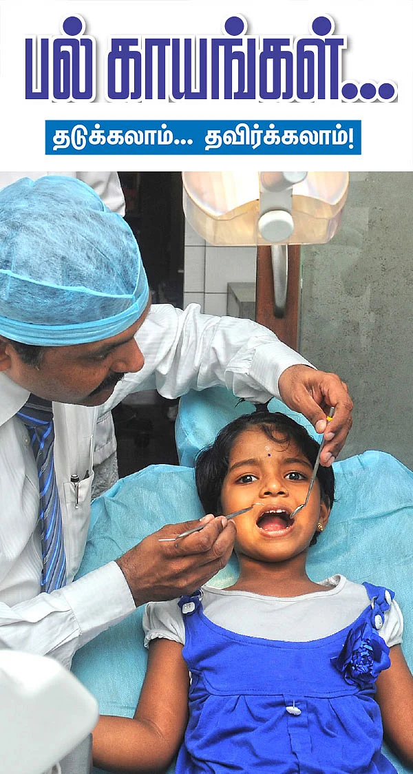 பல் காயங்கள்... தடுக்கலாம்... தவிர்க்கலாம்!