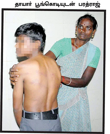 சிறுநீர் குடிக்கச் சொன்னார்களா?