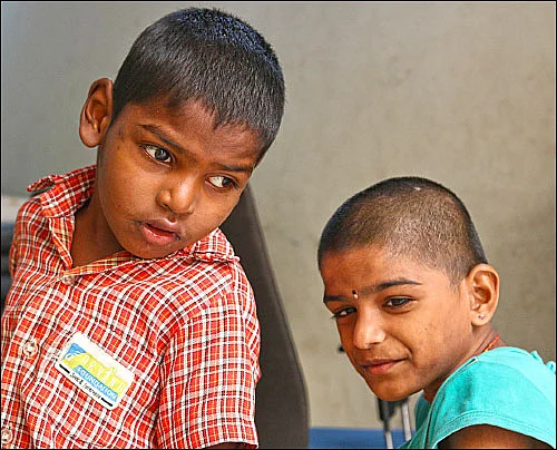 அறிவோம்... தெளிவோம்; ஆட்டிஸக் குழந்தையையும் சாதனையாளராக்கலாம்!