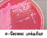 தாம்பத்ய வாழ்க்கையை தடுமாற வைக்கும் ஈ-கோலை...!