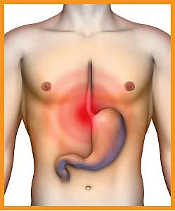 நெஞ்சு எரிச்சல்