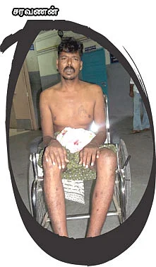 ''கத்தியால கீறி... உப்பு, மிளகாய் பொடி போட்டாங்க!''