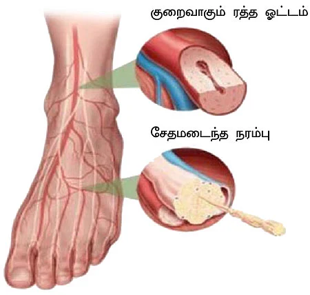 ஸ்வீட் எஸ்கேப் - 12