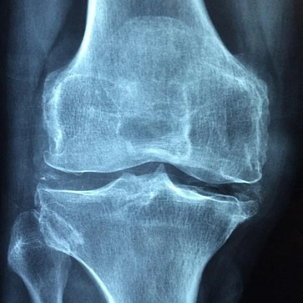 bone