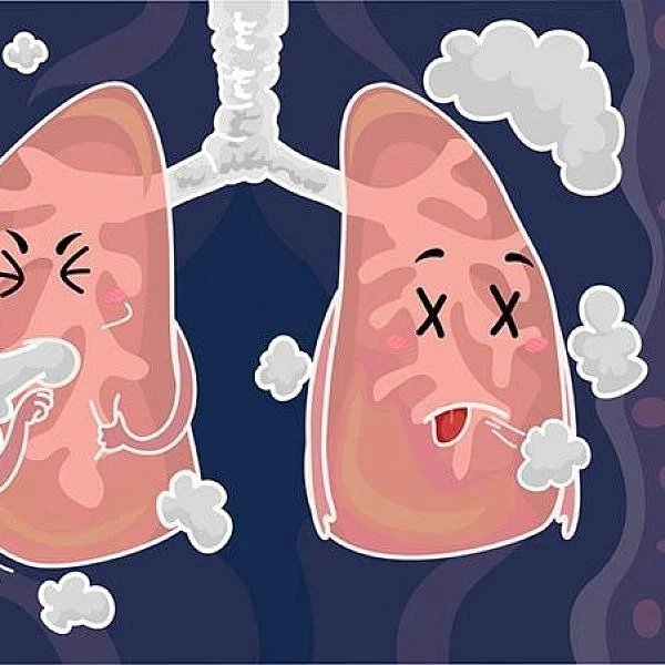 புகைபிடிப்பவர்களைக் குறிவைக்கும் நுரையீரல் தழும்பு நோய்! #PulmonaryFibrosis #PFAwarenessMonth