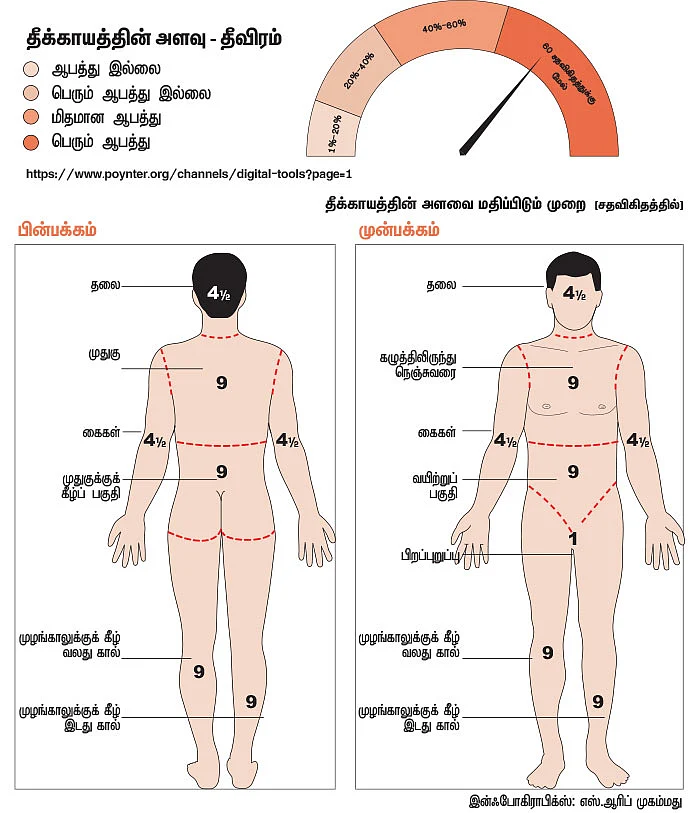 தீயினால் சுட்டபுண் - சந்தேகங்கள்... சிகிச்சைகள்