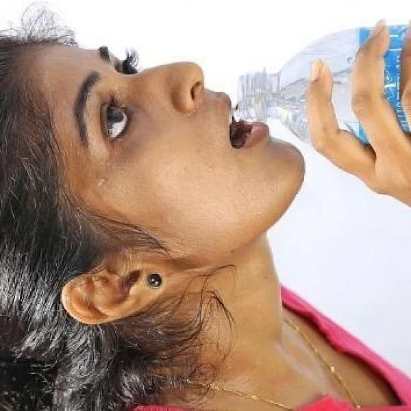 மஞ்சள்காமாலை முதல் எலிக்காய்ச்சல் வரை... கோடையில் நீரால் பரவும் நோய்கள்... தவிர்க்கும் வழிகள்!