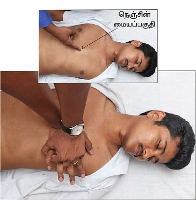 முதலுதவி யாருக்கு? எப்போது? எப்படி?
