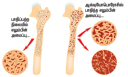 எலும்பின் கதை! - 9 - உச்சி முதல் உள்ளங்கால் வரை வெர்ஷன் 2.0