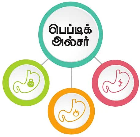 பெப்டிக் அல்சர்