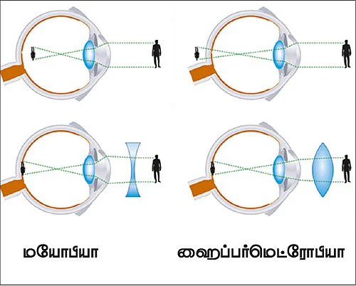 நில்... கவனி... ‘கண்’மணி!