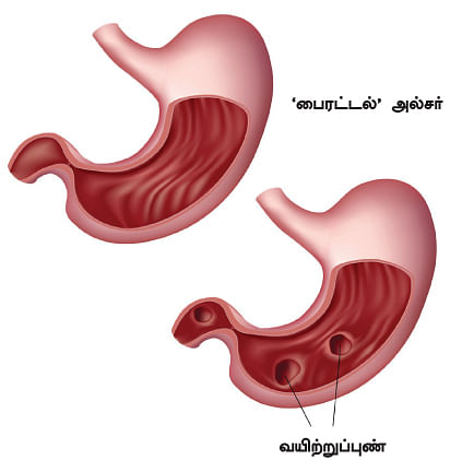 இப்படிக்கு வயிறு! - 17