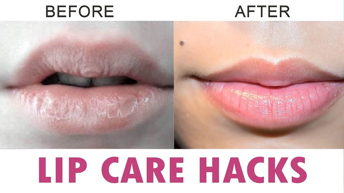 Lip care