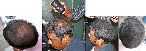 முடிசூட நீங்கள் தயாரா?