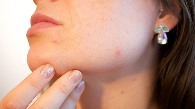 skin care