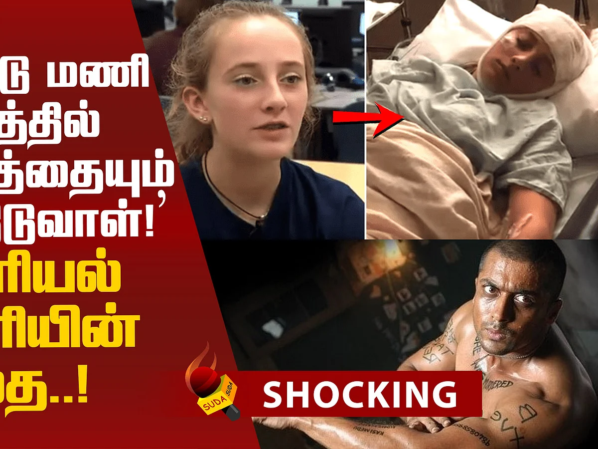 Teenager’s memory resets every two hours after the traumatic kick to the head!