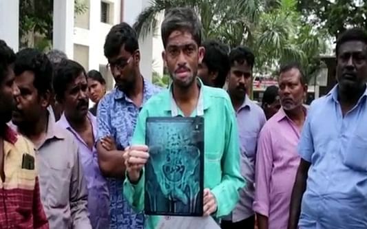 `ஊசி உடைஞ்சு இடுப்பு எலும்புல சிக்கிக்கிச்சு!' - கோவை மருத்துவமனை மீது இளைஞர் புகார்