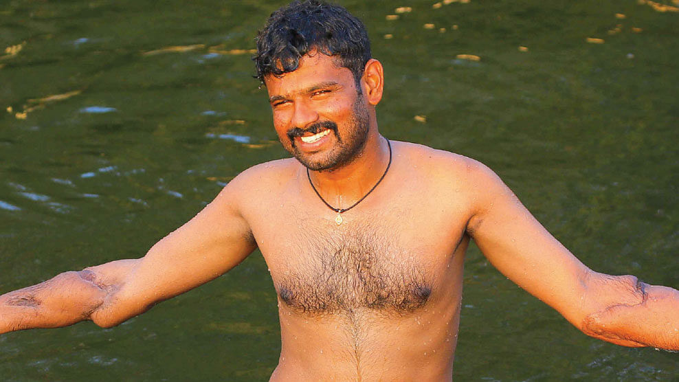 கைமாற்று அறுவை சிகிச்சைக்குப் பின்