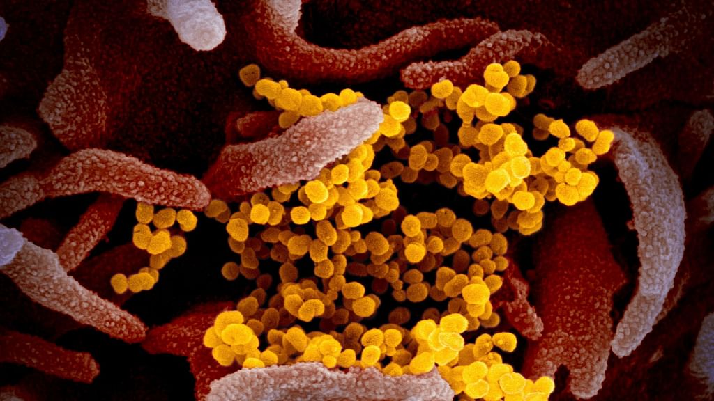 Novel Coronavirus SARS-CoV-2