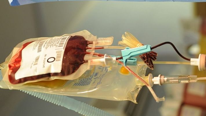 Plasma treatment (Representational Image)