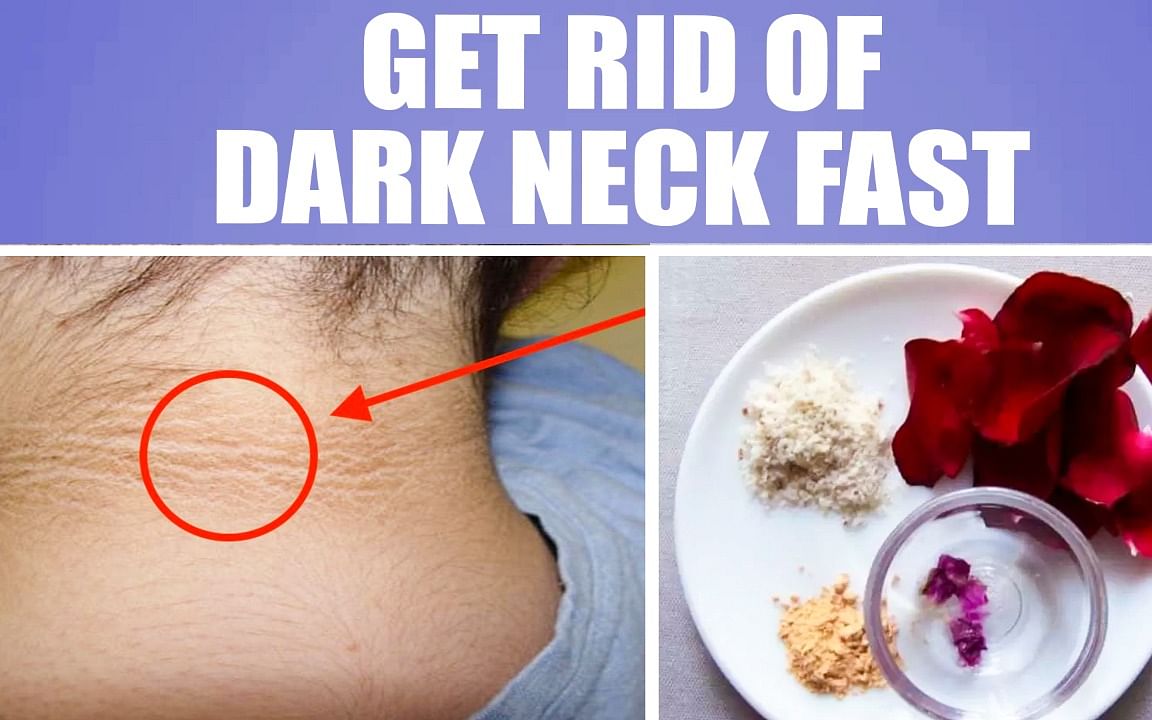 How to: கழுத்துக் கருமையில் இருந்து விடுபடுவது எப்படி? | How to get rid of dark neck?