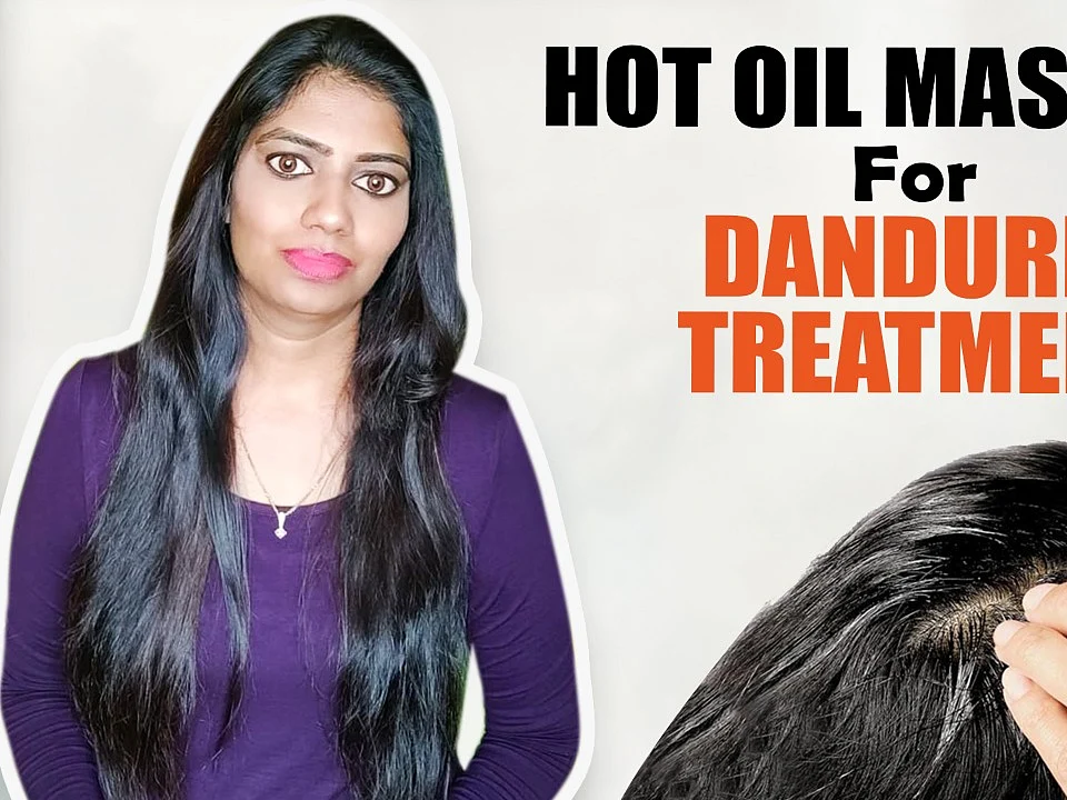 பொடுகு தொல்லை இனி இல்லை.. இத ட்ரை பண்ணி பாருங்க! | Dandruff remedies #15dayschallenge Day 7