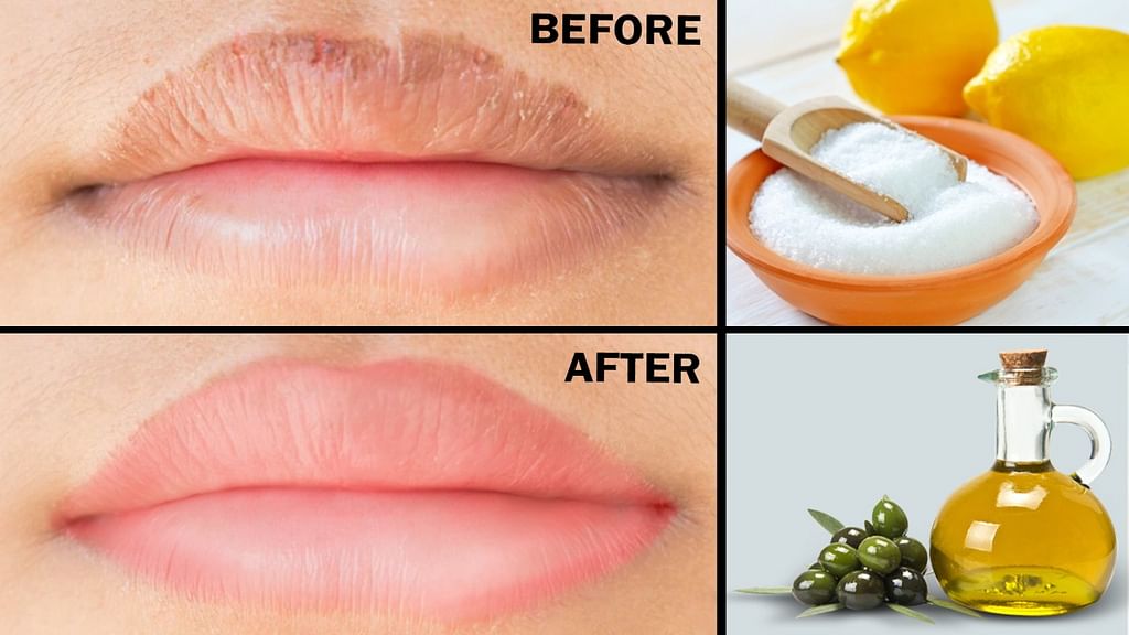 lips