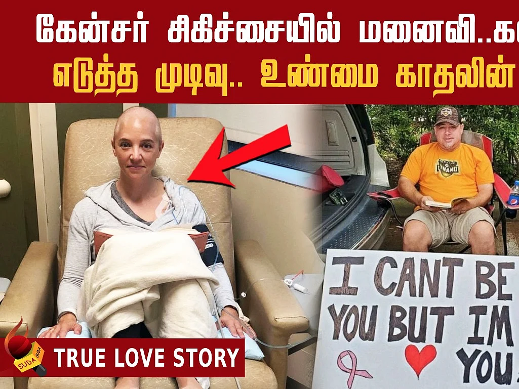 தலைமுடி இழந்து சோகத்தில் மனைவி... கணவன் செய்த காதல் செயல் ! | Corona Updates