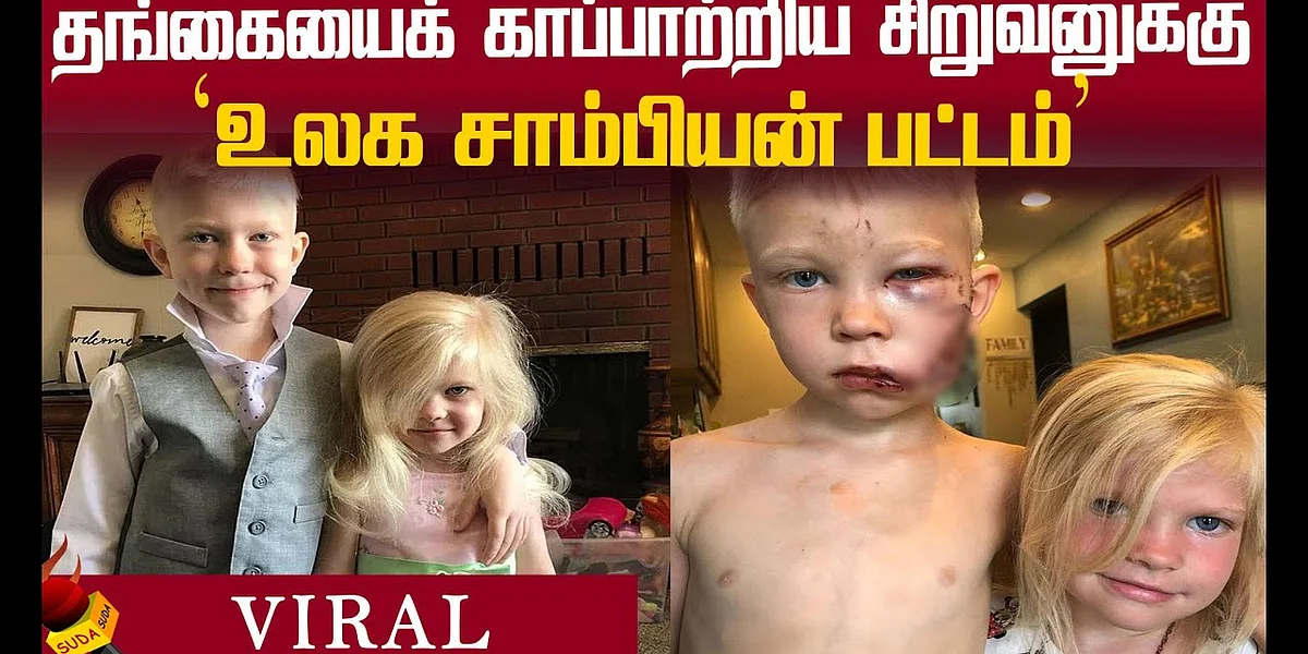 Viral