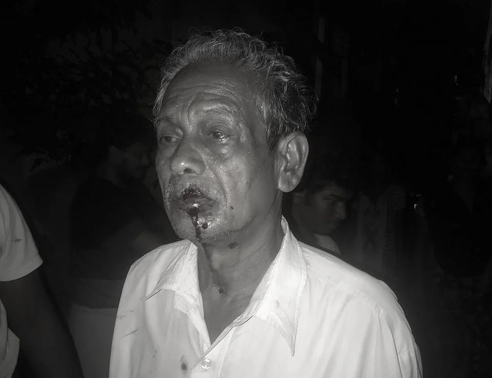 கஞ்சா பாய்ஸால் தாக்கப்பட்ட முதியவர்